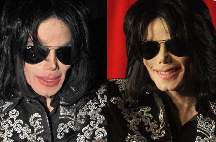 Khuon mat Michael Jackson bi pha hong the nao sau dao keo-Hinh-8